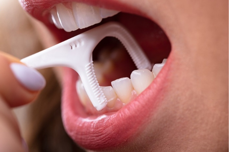 Bạn nên đưa chỉ nha khoa vào kẽ răng và nhẹ nhàng loại bỏ vụn thức ăn, mảng bám.