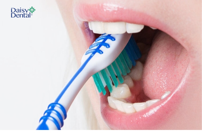 Bạn nên vệ sinh răng miệng theo khuyến nghị của nha khoa.
