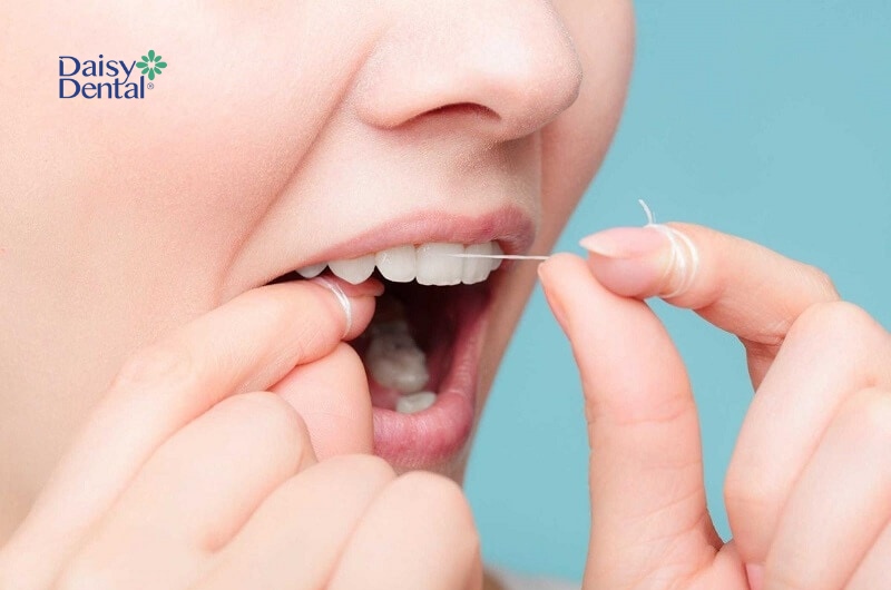 Sử dụng chỉ nha khoa với lực quá mạnh cũng có thể dẫn đến chảy máu.