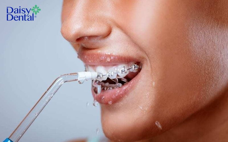Máy tăm nước giúp làm sạch sâu các kẽ răng