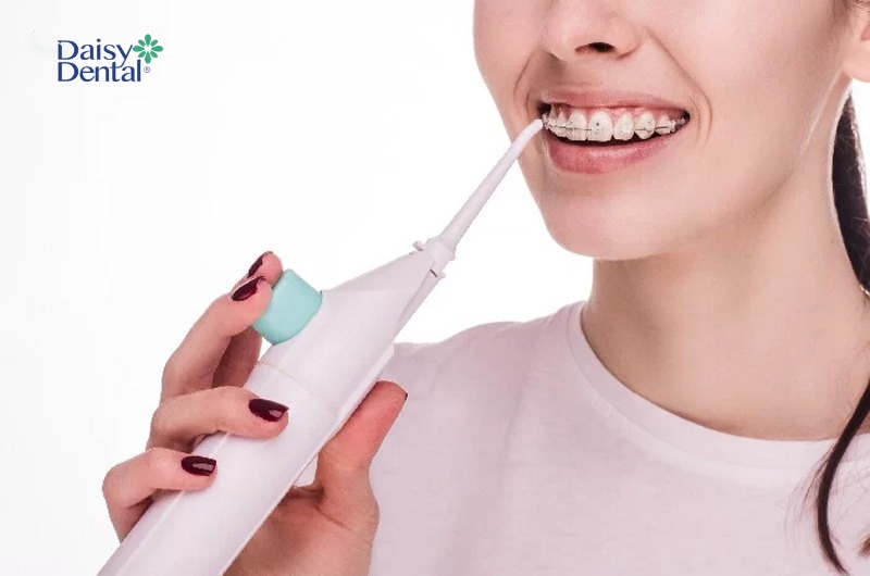 Máy giúp người niềng răng vệ sinh răng miệng hiệu quả