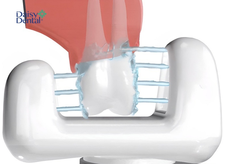 Sản phẩm này có khả năng làm sạch 2 bề mặt răng cùng lúc