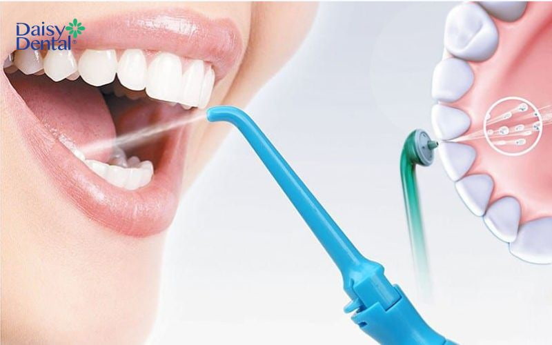 Tia nước mảnh giúp máy tăm nước Rapido tối ưu hóa nhiệm vụ làm sạch kẽ răng