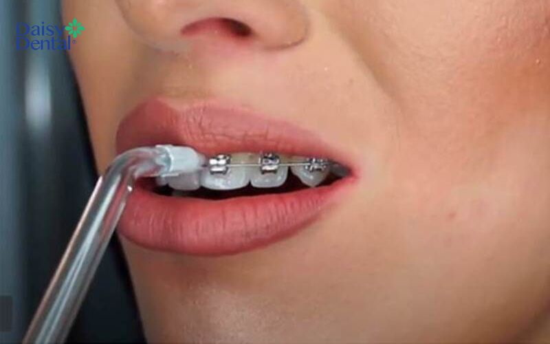 Chị Hoài Thu đánh giá rất tốt về máy tăm nước Rapido