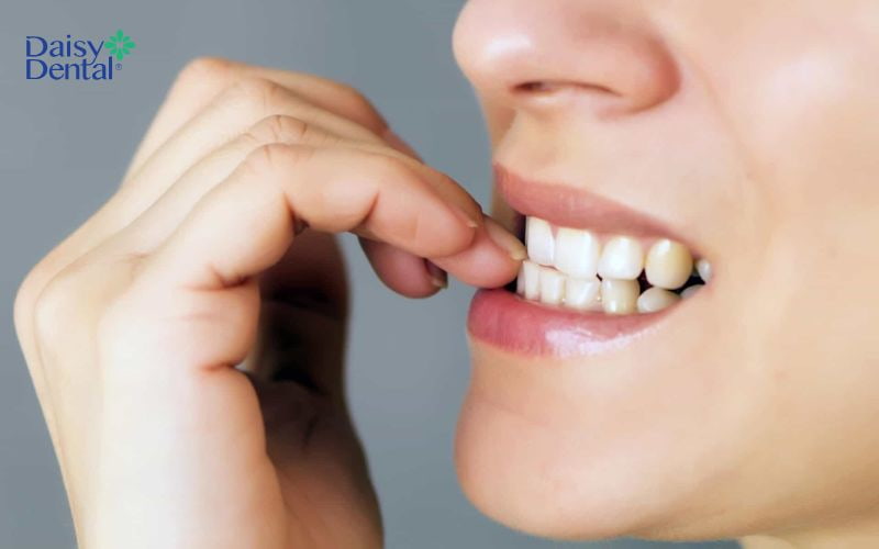 Bỏ thói quen xấu để đảm bảo kết quả niềng răng