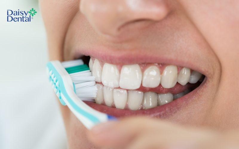 Đánh răng quá mạnh theo chiều ngang là một trong những nguyên nhân gây tụt lợi