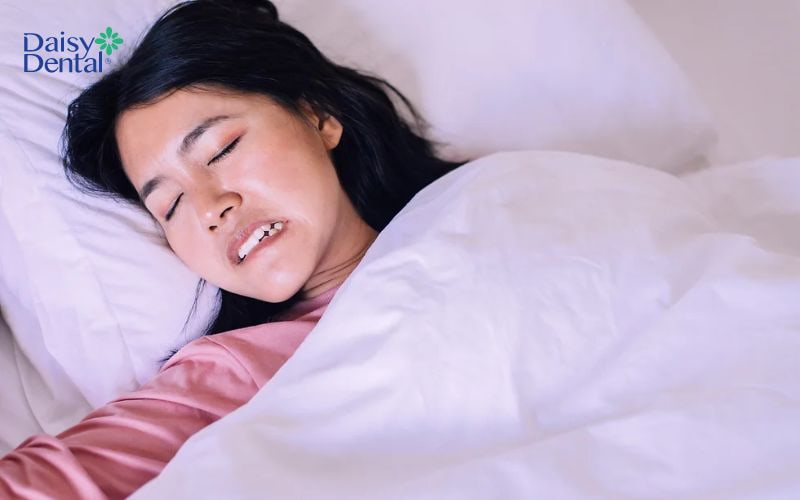 Nghiến răng là một trong những nguyên nhân gây tụt lợi