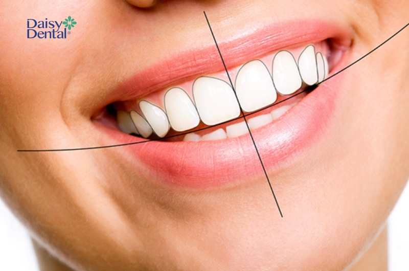 Trước khi phẫu thuật, bác sĩ sẽ tiến hành đo, vẽ theo tỷ lệ phù hợp nhằm đạt kết quả cao nhất