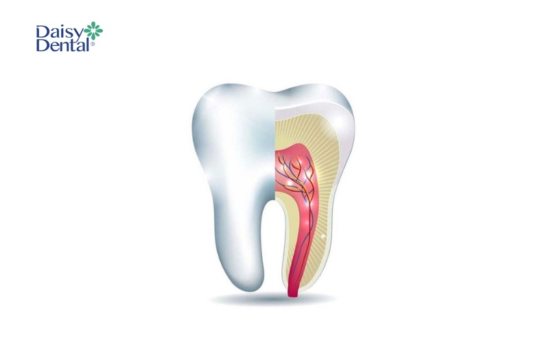 Tủy răng được xem là nơi nuôi sống chiếc răng. 