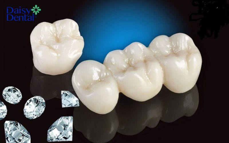 Răng sứ cao cấp Diamond