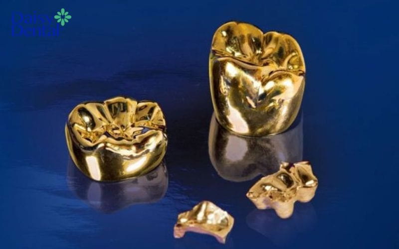 Răng sứ cao cấp từ kim loại quý Au-Pd