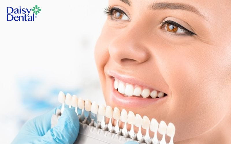 Tùy vào nhu cầu thẩm mỹ mà người dùng sẽ cân nhắc lựa chọn dòng răng sứ phù hợp