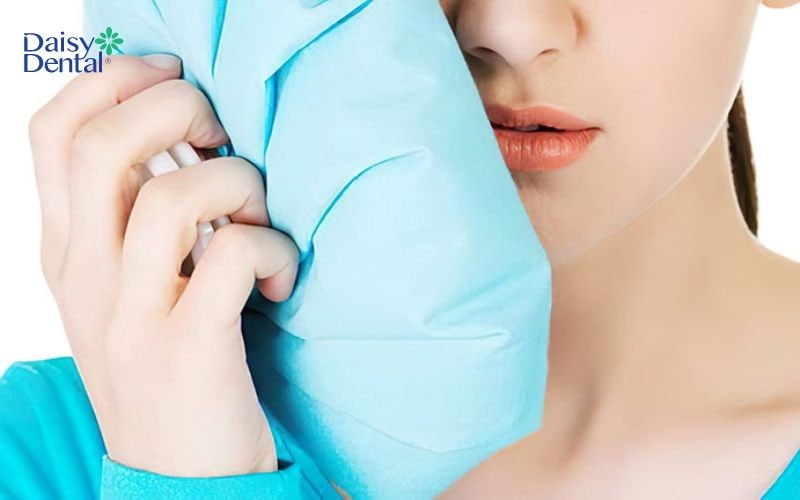 Có thể chườm lạnh để giảm đau nhức sau khi nhổ răng mọc trong cùng