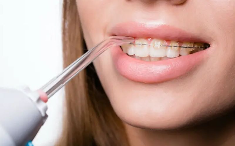 Dùng máy Lock&Lock để vệ sinh răng miệng hàng ngày, đặc biệt là đối với những ai đang niềng răng