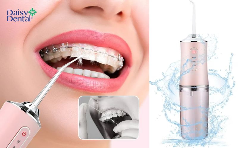 Hiệu quả làm sạch vượt trội là ưu điểm hàng đầu của máy Oral Irrigator