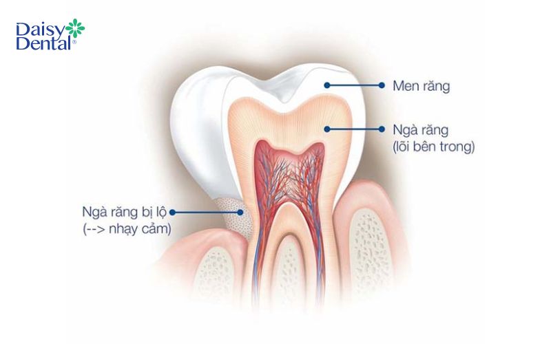 Men răng là lớp cứng chắc bao bọc bên ngoài toàn bộ thân răng