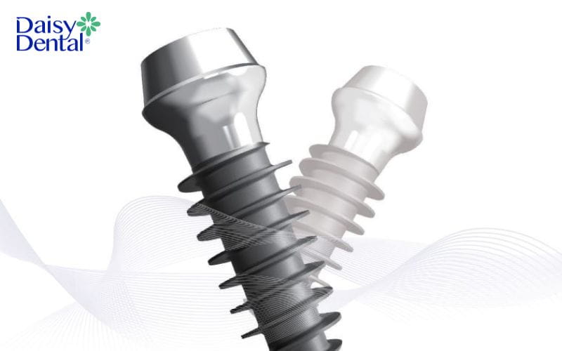Implant Magicore