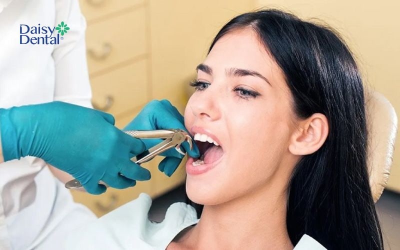 Niềng răng không nhổ răng có được không cần được bác sĩ thăm khám và chỉ định