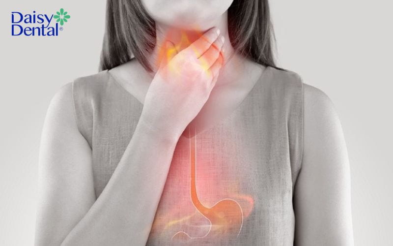Nuốt nước bọt thấy vướng ở cổ họng
