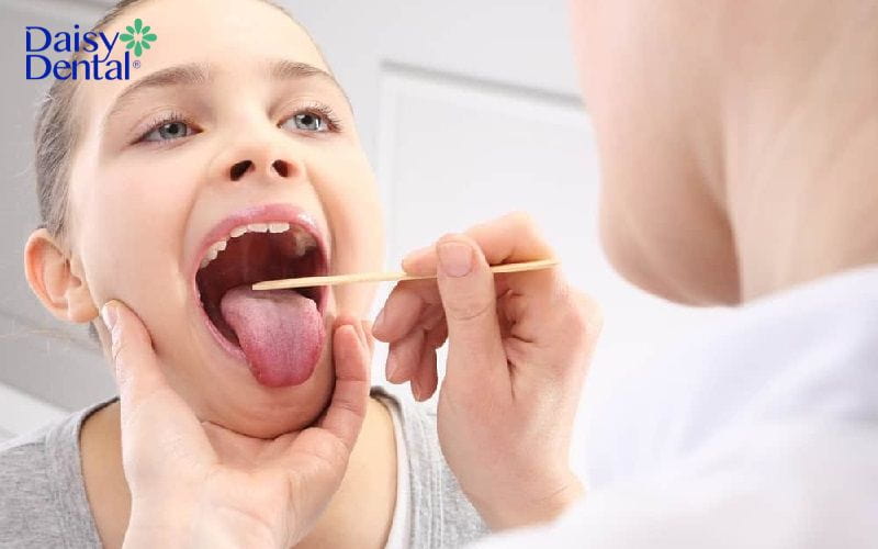 Nuốt nước bọt thấy vướng ở cổ họng