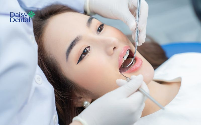 Bác sĩ tiến hành kiểm tra răng miệng trước khi siết răng