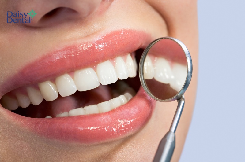 Thực phẩm có ảnh hưởng lớn đến sức khỏe răng miệng của mỗi người