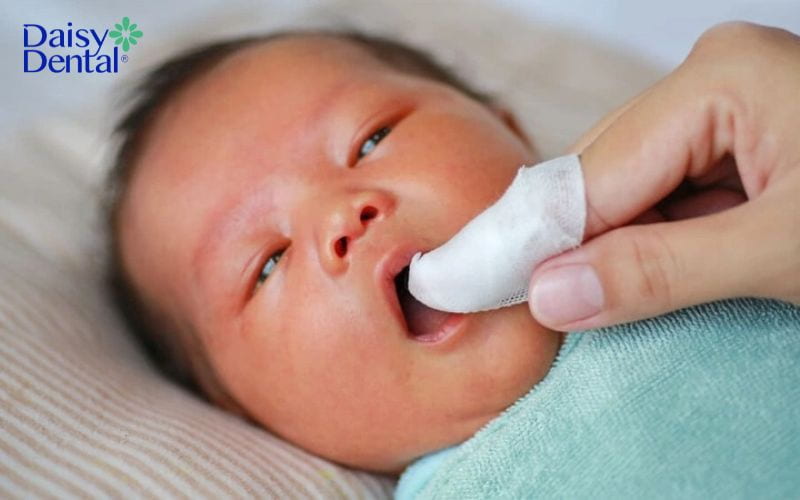 thuốc rơ lưỡi cho trẻ sơ sinh