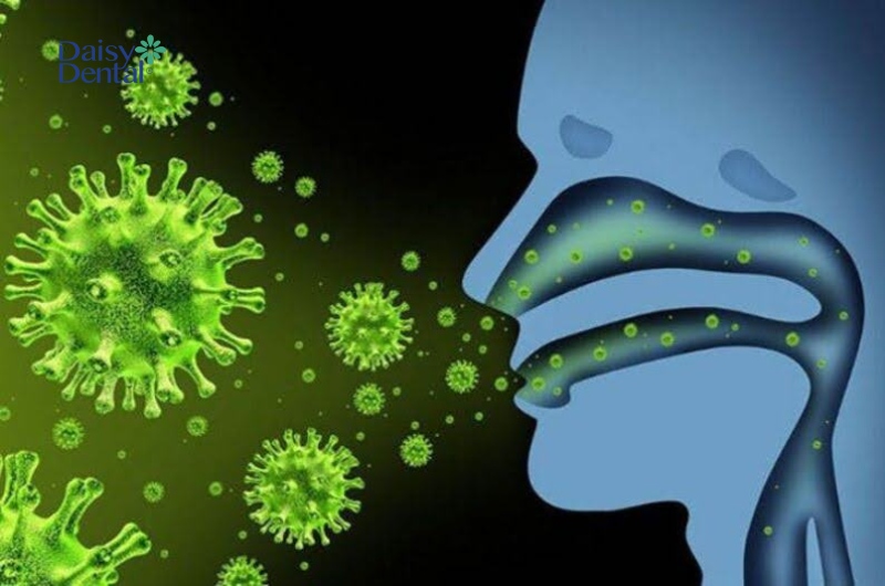 Viêm xoang do virus có khả năng lây nhiễm cao