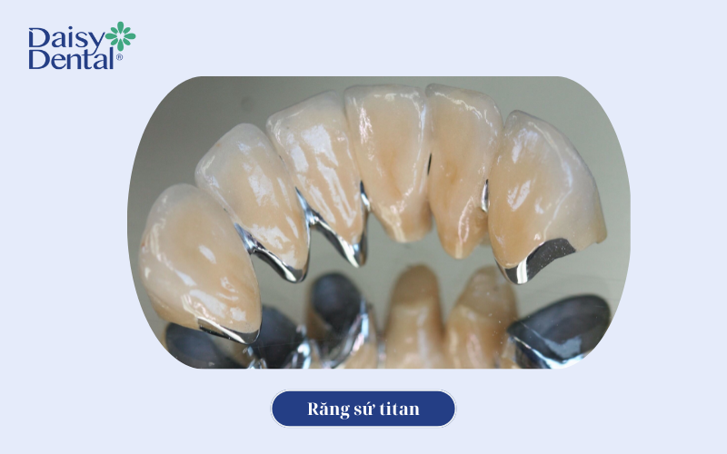 Bọc răng sứ 11