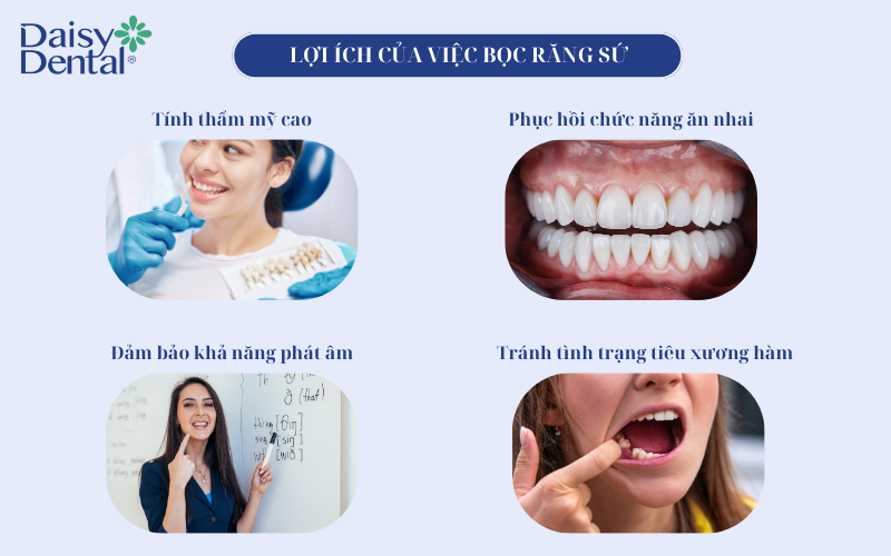 Bọc răng sứ 8
