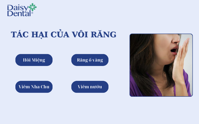 Cạo vôi răng 3