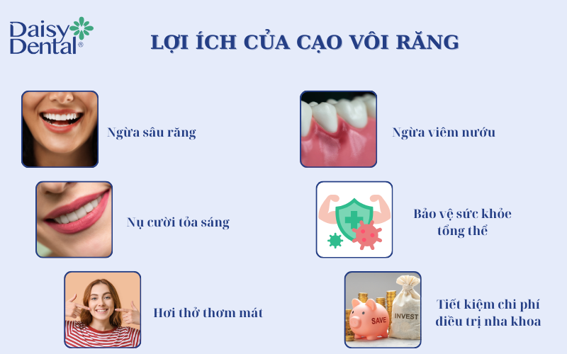 Cạo vôi răng 4