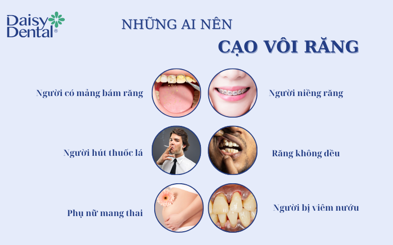 Cạo vôi răng 5