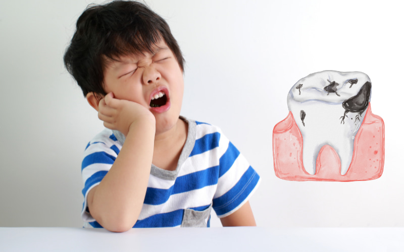 Sâu răng là tác hại phổ biến nhất, gây đau nhức, khó chịu, ảnh hưởng đến việc ăn nhai và giấc ngủ của trẻ.