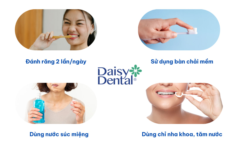Việc chăm sóc răng miệng đúng cách sau khi dán sứ Veneer sẽ giúp bạn duy trì nụ cười rạng rỡ và tự tin trong thời gian dài.