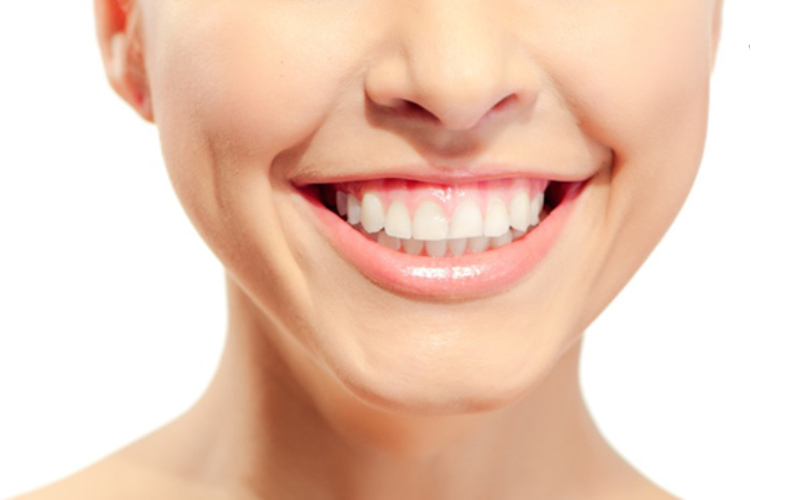 Cười hở lợi gây mất thẩm mỹ cho nụ cười.