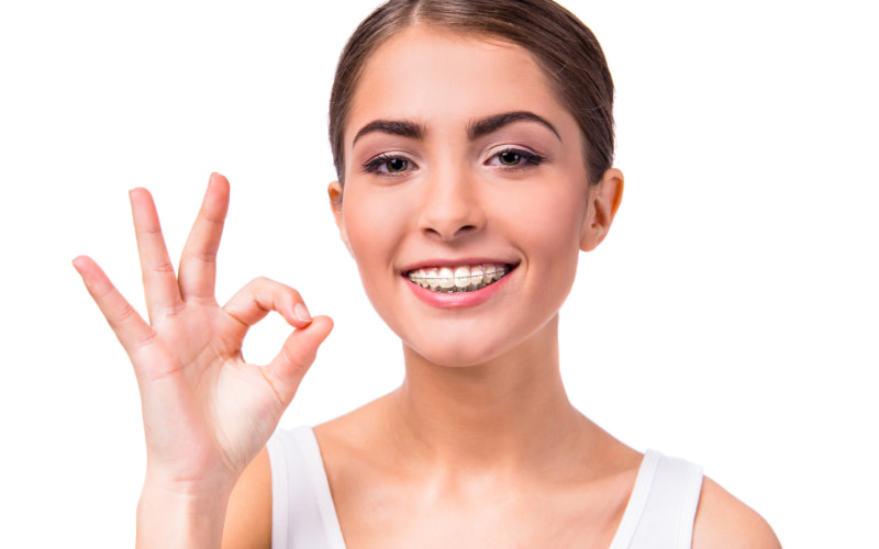 Niềng răng là một phương pháp điều trị cười hở lợi hiệu quả trong một số trường hợp nhất định.