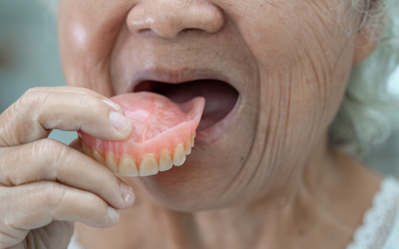 Hàm giả tháo lắp dễ dàng sử dụng và vệ sinh, phù hợp với người lớn tuổi.