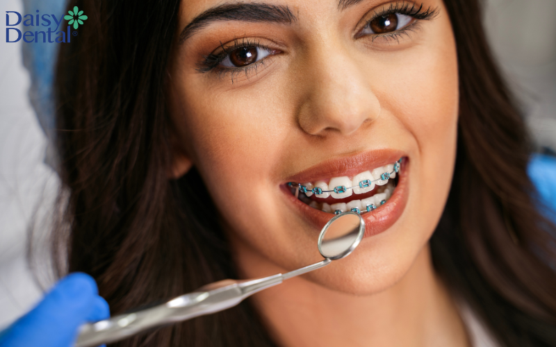 Lấy cao răng có tác dụng gì 7