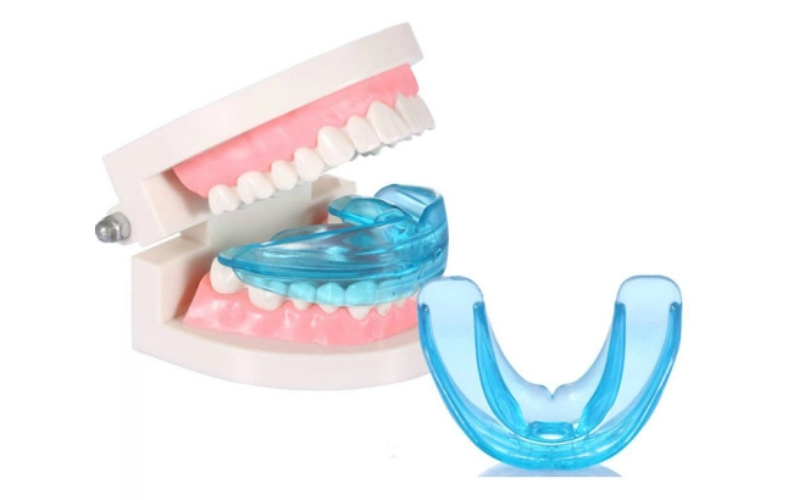 Niềng răng bằng nhựa silicon