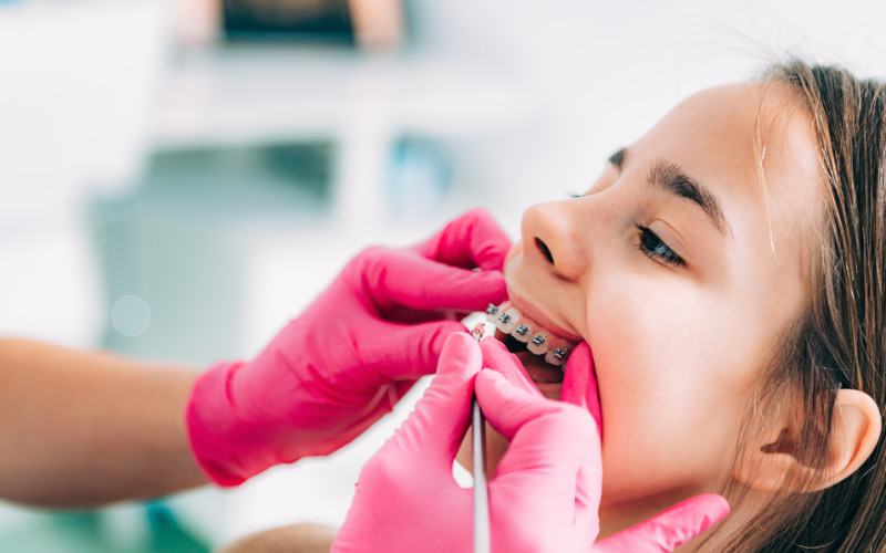 Trước khi quyết định niềng răng cho trẻ, bạn nên đưa trẻ đến gặp bác sĩ nha khoa để được tư vấn và đánh giá tình trạng răng miệng. 