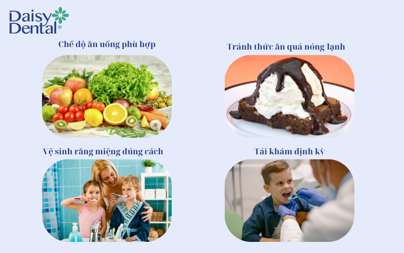Trám răng ở trẻ em 7