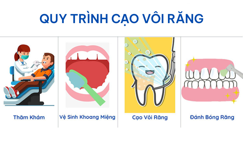 Quy trình lấy cao răng an toàn cần được thực hiện bởi bác sĩ có kỹ thuật tại phòng khám uy tín