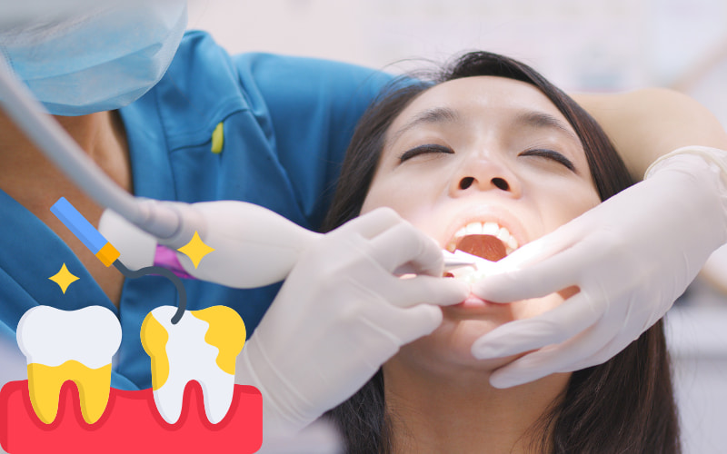 Cạo vôi đánh bóng răng giúp làm sạch các mảng bám cứng ra khỏi bề mặt răng, mang lại nhiều lợi ích cho sức khỏe răng miệng.