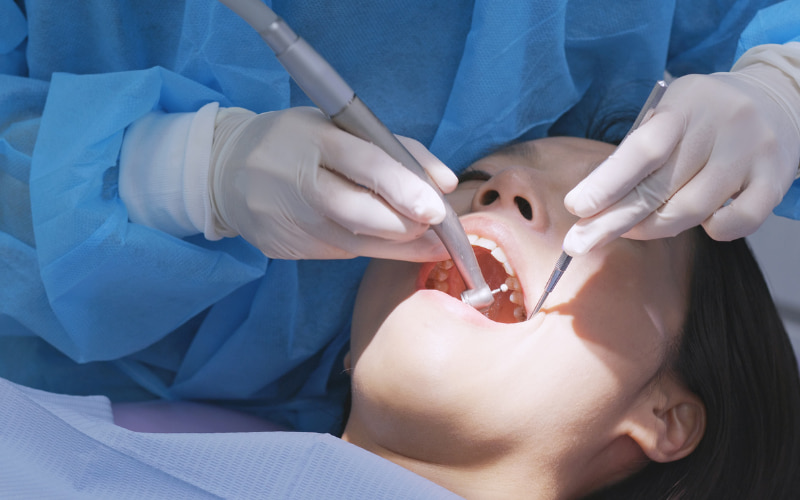 các nha sĩ khuyên bạn nên lấy cao răng định kỳ 3-6 tháng một lần