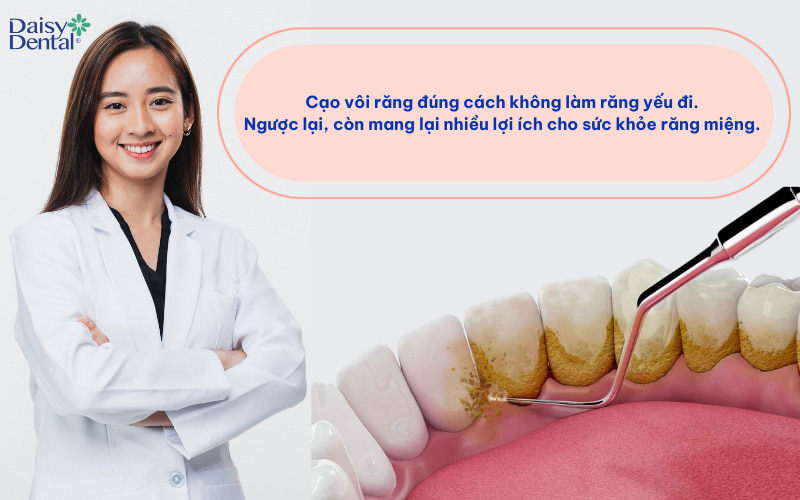 cạo vôi răng là một thủ thuật nha khoa an toàn và có lợi nếu được thực hiện đúng cách.