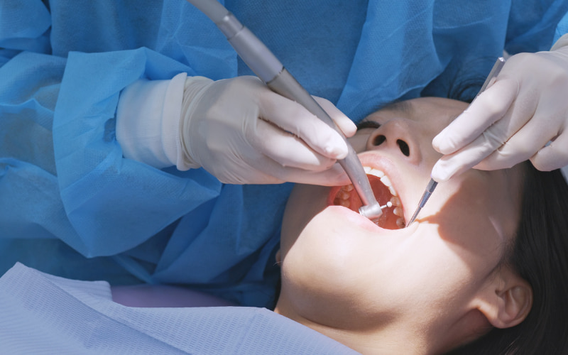 Tần suất lý tưởng thường là 3-6 tháng một lần, tùy thuộc vào tình trạng răng miệng của mỗi người.