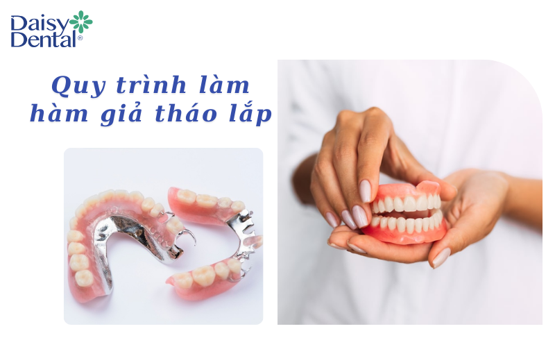 Hàm răng giả 7