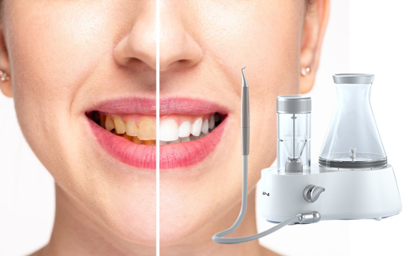 Lấy cao răng bằng máy thổi cát mang lại nhiều lợi ích vượt trội so với các phương pháp truyền thống.