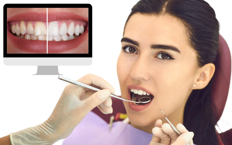 Nếu thực hiện đúng kỹ thuật bởi nha sĩ có chuyên môn, thường không gây ảnh hưởng xấu đến răng mà ngược lại, còn mang lại nhiều lợi ích cho sức khỏe răng miệng